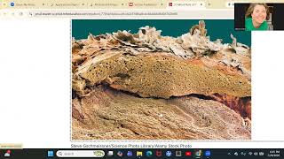 MLA HIM111 Ch3 Part 1 Lecture Video