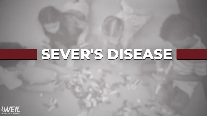 Dr. Misty McNeill on children and Sever's Disease