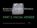 Anterior Veneers, Part 2, Facial Veneer