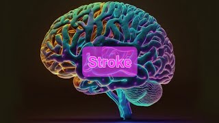 Stroke ppt