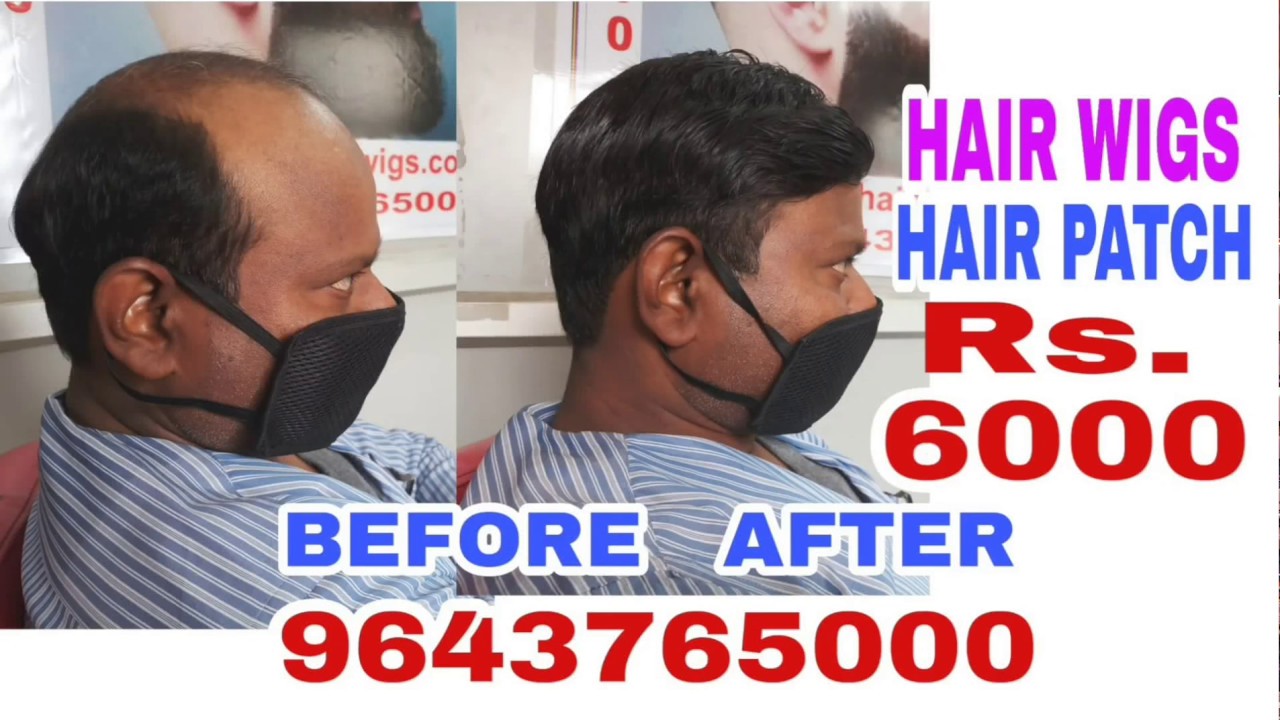 Hair Wigs Store in Delhi 9643765000 Hair Wigs for Men YouTube