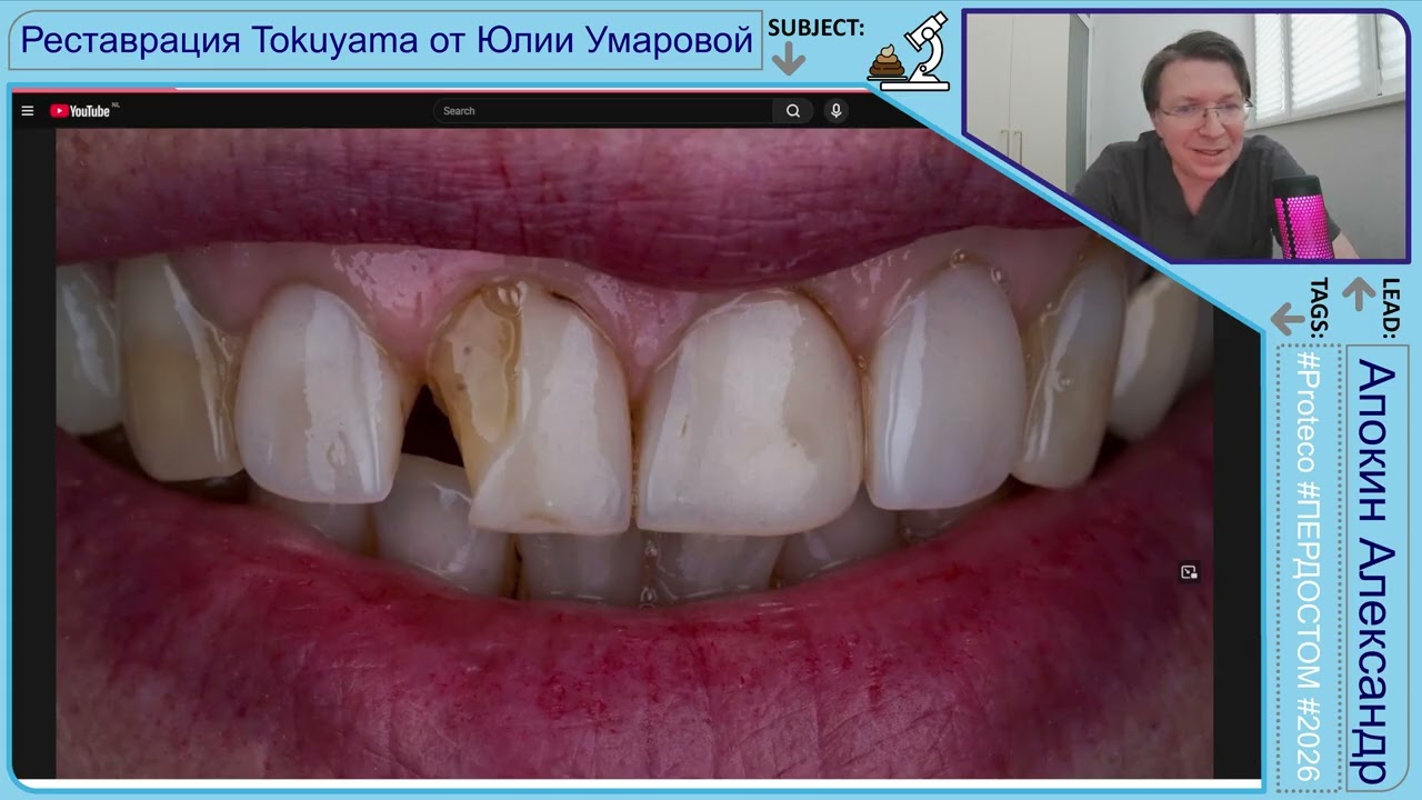 Реставрация композитами от Юлии Умаровой #proteco #пердостом 4K