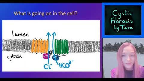 Cystic Fibrosis - Simplified!
