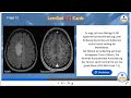 Lernrad gocards  neuroradiologie fr die facharztprfung radiologie und fr die weiterbildung
