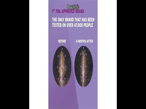 Rogaine 5% Minoxidil Foam for Women Review: Regrow Thicker Hair, No Mess