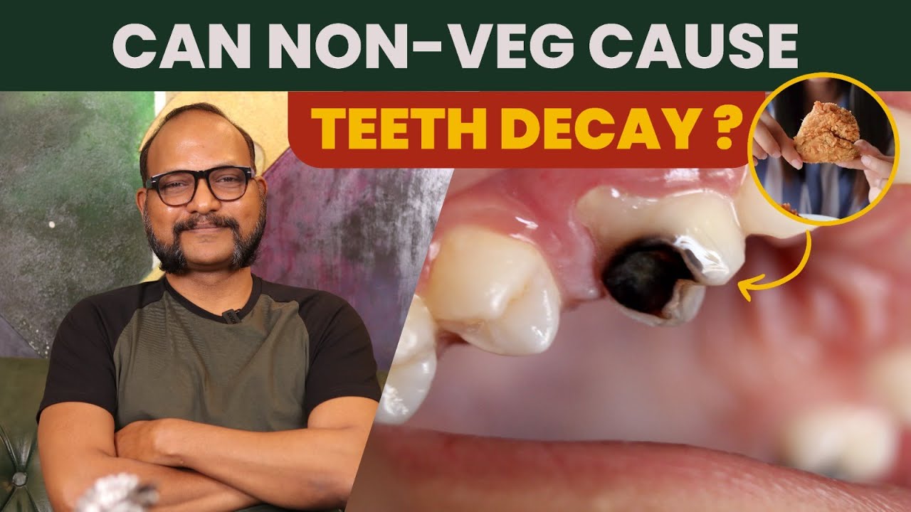 Can nonveg cause tooth decay ? Dr. Prabhakar Joseph YouTube