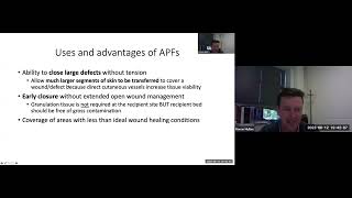 Advanced Soft Tissue Surgery: Axial Pattern Flaps