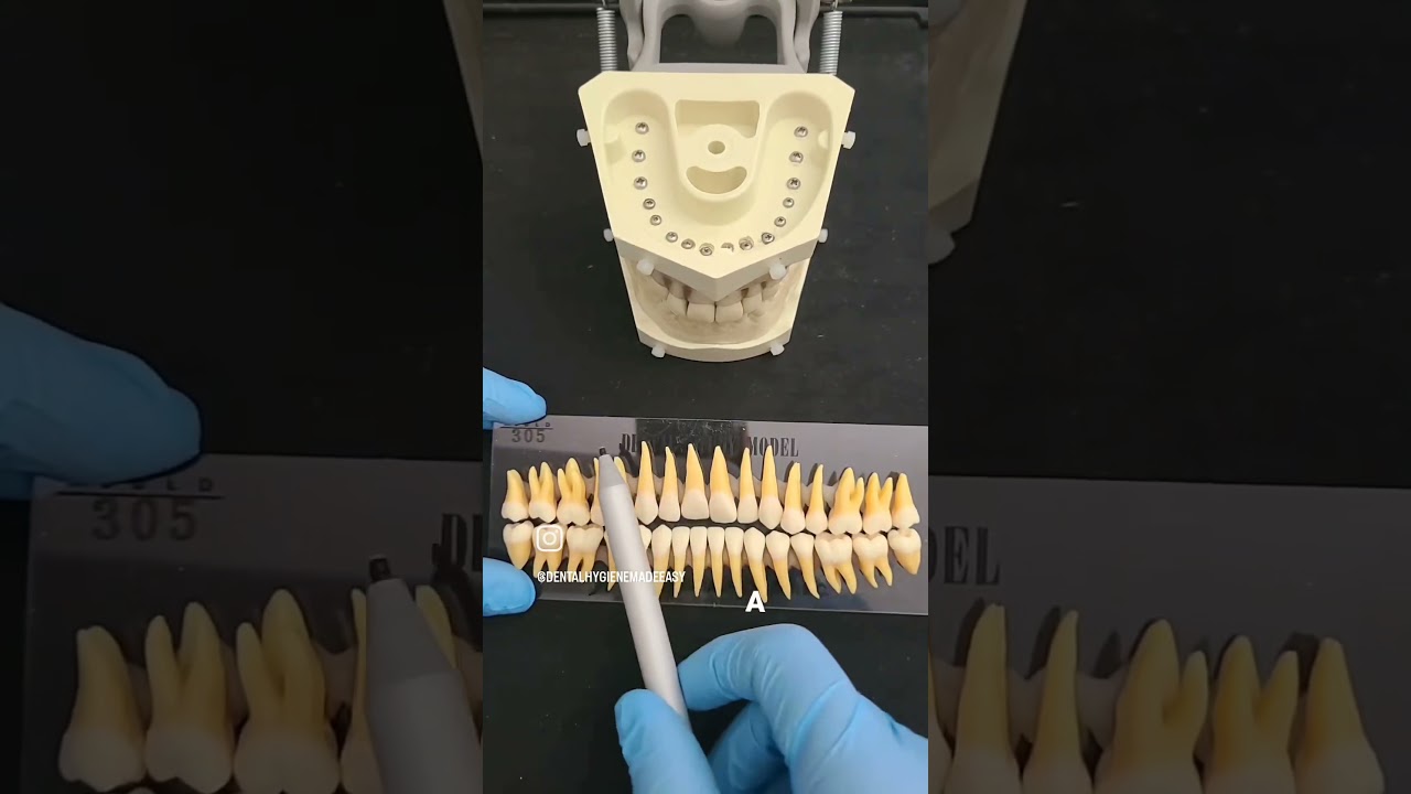 🦷✨ Dental Tip: How to Differentiate Right Teeth from Left Teeth! ✨🦷