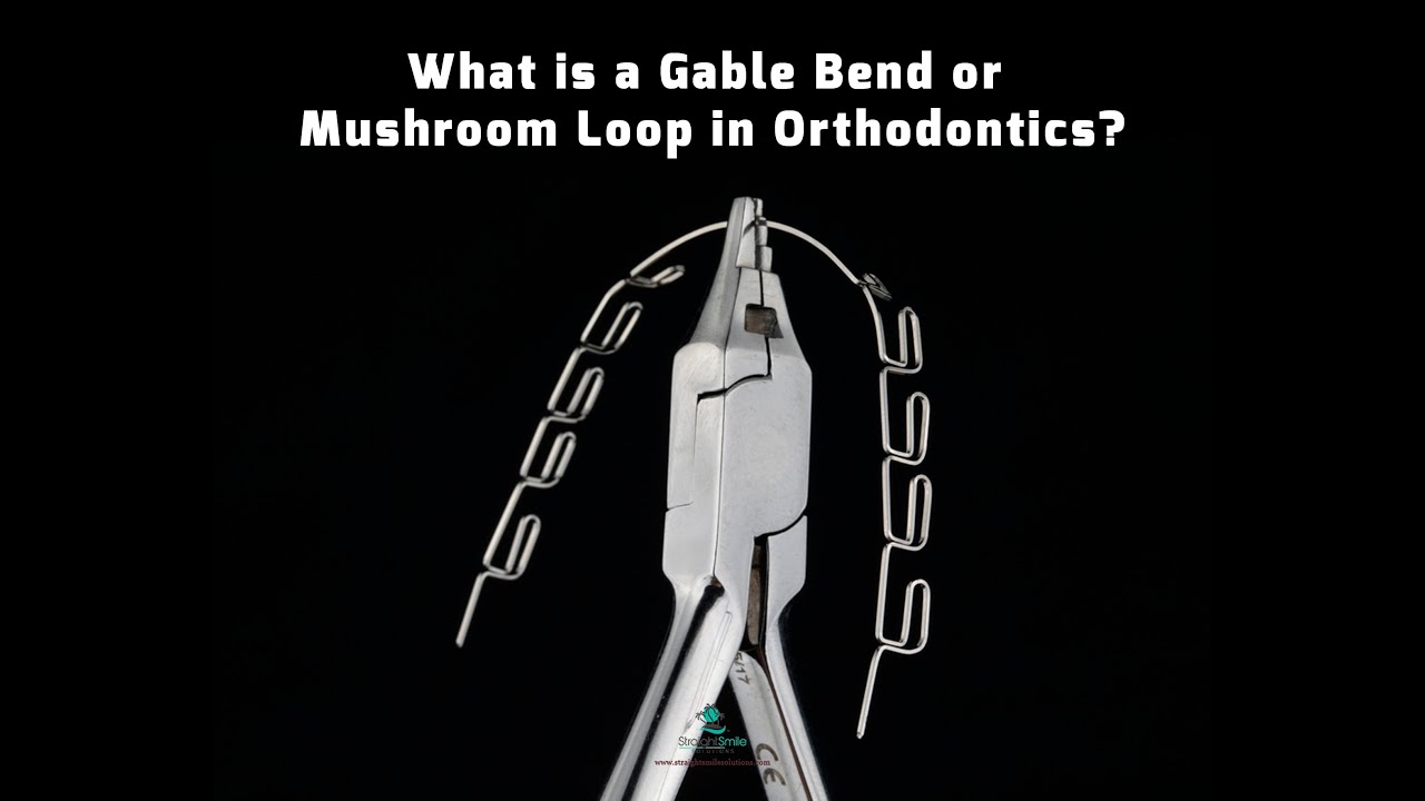 Retraction Loops, Gable Bends and Mushroom Loops in Braces YouTube