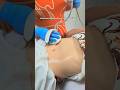 Flacidez Região Íntima #venuslegacy #emagrecimento #dermatologista