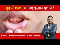 Mouth ulcers :  Know why they happen ? | By Dr. Bimal Chhajer | Saaol