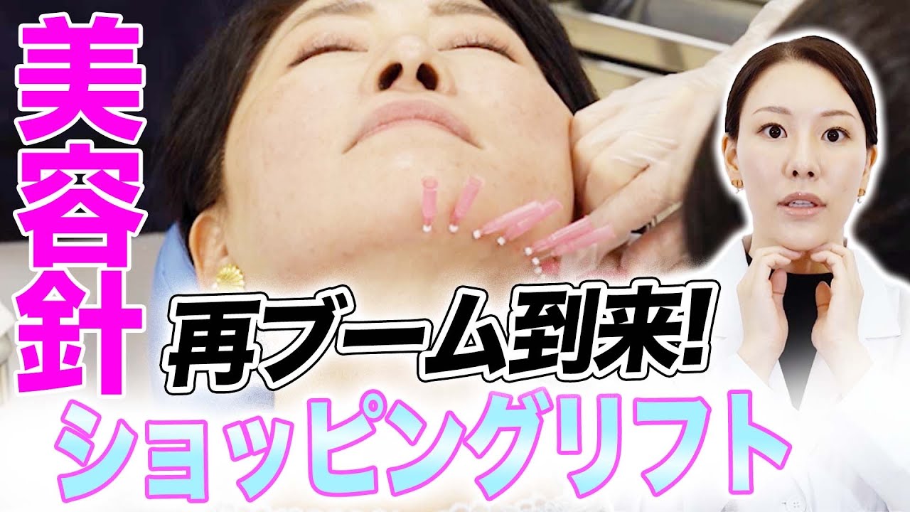 【ブーム再到来】ショッピングリフト・美容針の魅力について解説します。
