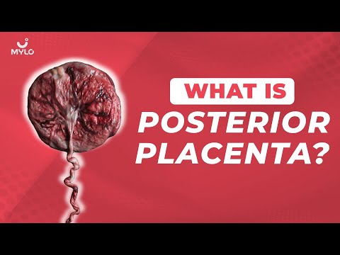 वीडियो: पोस्टीरियर प्लेसेंटा क्या है?