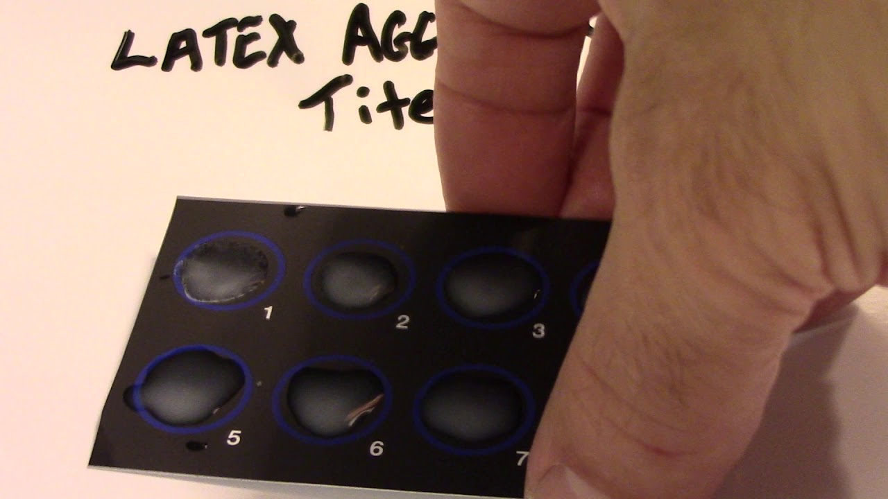 Latex Agglutination Part 5 YouTube