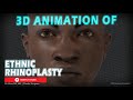 Dr bora ok md  3d animation of ethnic rhinoplasty surgery