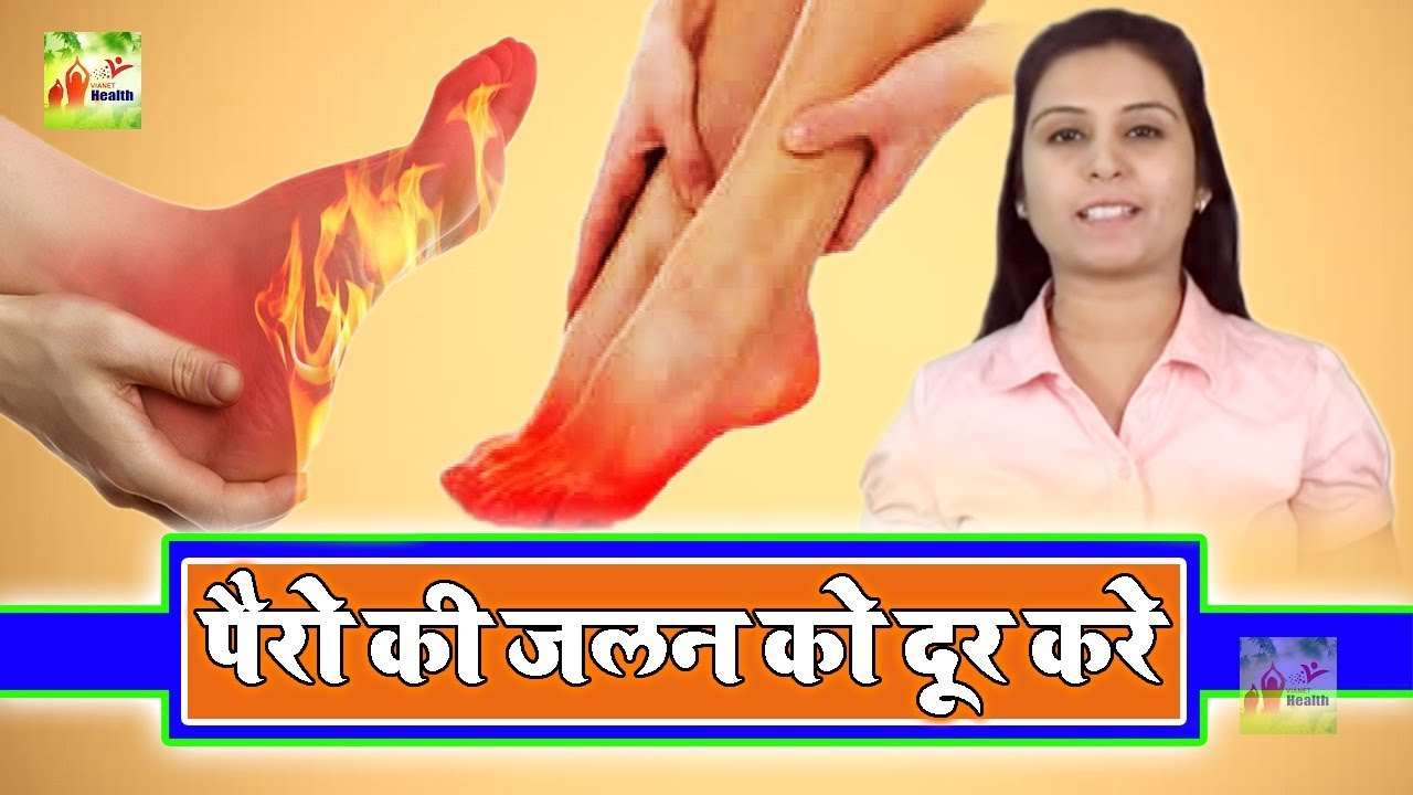 पैरों के तलवों की जलन को दूर करने के घरेलू उपाय !! Natural Home