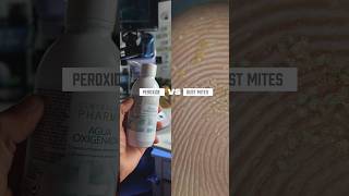 PEROXIDE VS DUST MITES