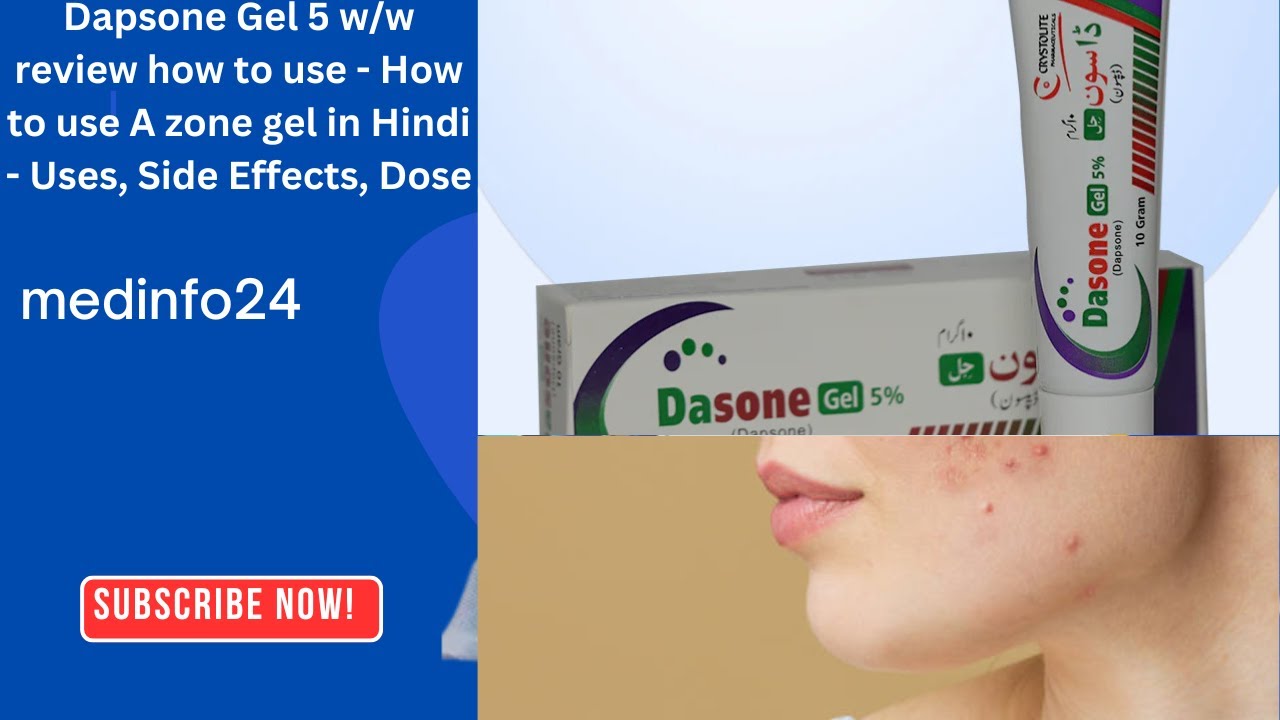 Dapsone Gel 5 w/w review how to use - How to use A zone gel in Hindi - Uses, Side Effects, Dose