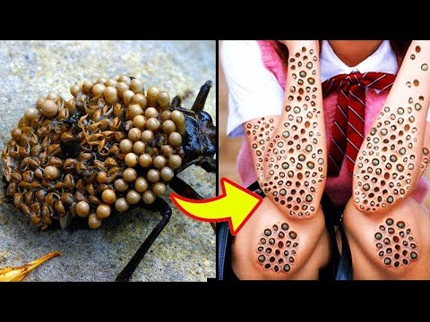 Самые Опасные Насекомые в Мире / Не Трогайте ИХ!!!