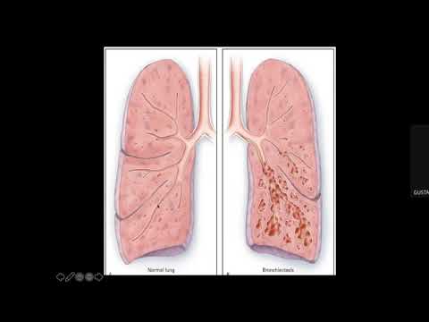 Semiologia del sistema respiratorio en pediatría