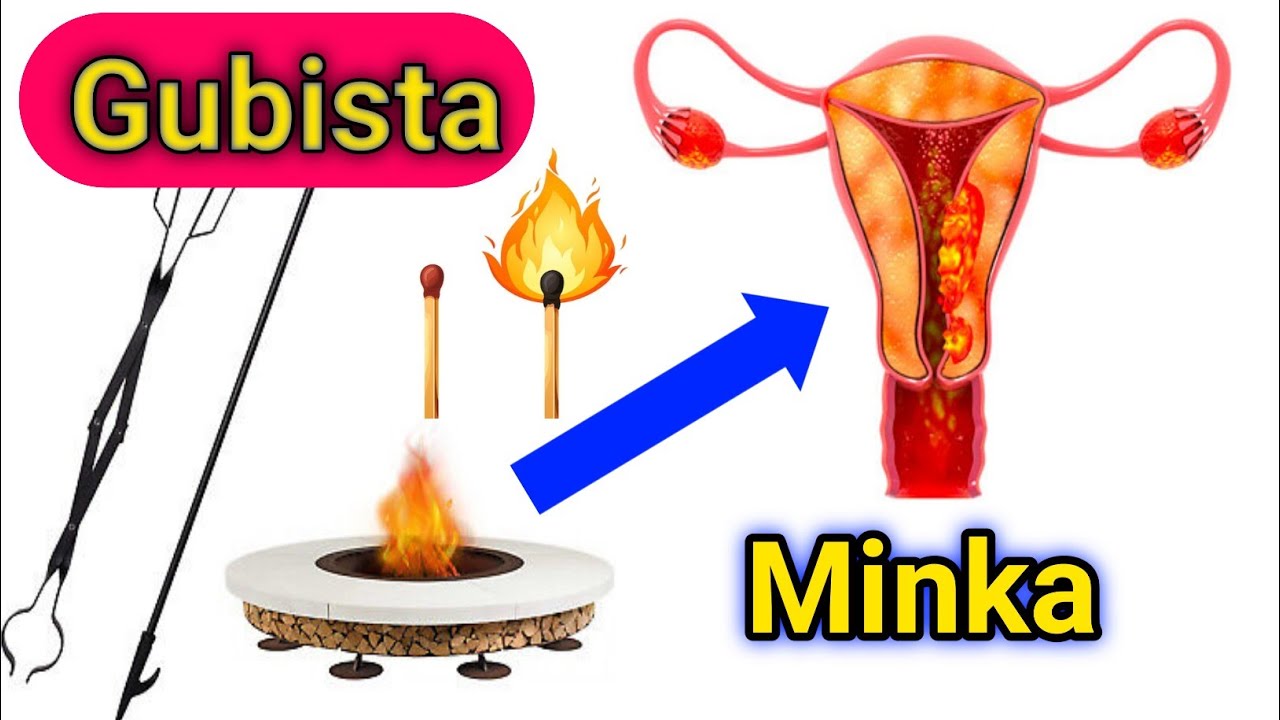 minka ama ilma galeenka sidaan u gub 🔥