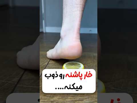 جوش شیرین لیمو ذوب شدن خارپاشنه