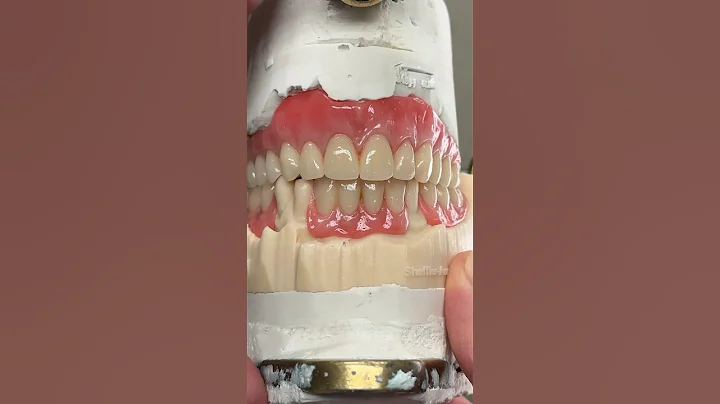 Upper and Lower Try-In @EnvisiontecMain #envisiontec #dental #teeth #smile #lsk121shorts #shorts