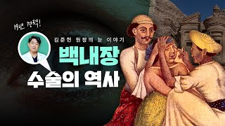 백내장 수술, 이렇게 시작됐습니다❗ 알아두면 놀라운 의학의 역사 #백내장 #백내장수술의역사
