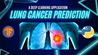 Lung Cancer Prediction with CNNs & TensorFlow: A Deep Learning Application