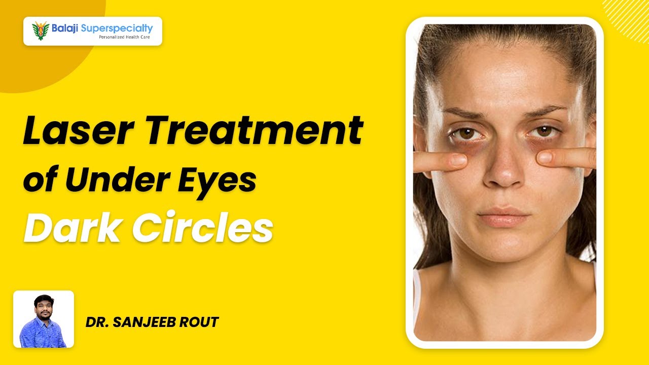 Laser Treatment Of Under Eyes Dark Circles Dr Sanjeeb Rout