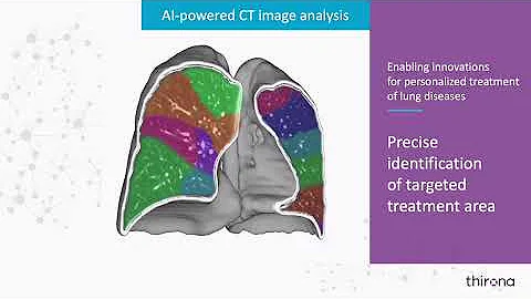 LungQ™ identification of targeted treatment area for preoperative planning