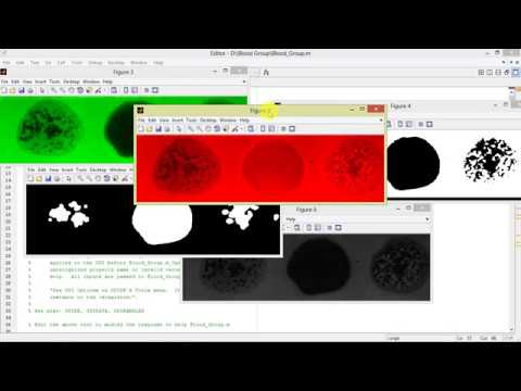 Blood Group Identification using Matlab