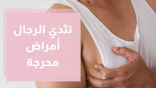 تثدي الرجال.. أمراض محرجة