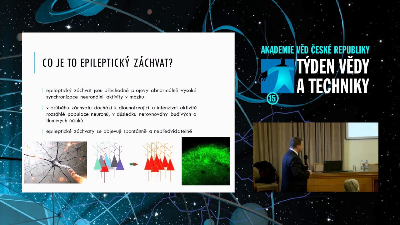 Nové poznatky o příčinách získané epilepsie