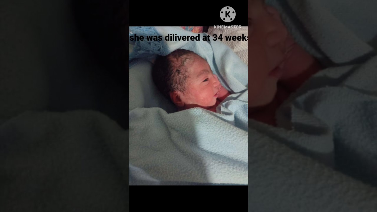 34 weeks baby born😰#emotional#ytshorts#baby