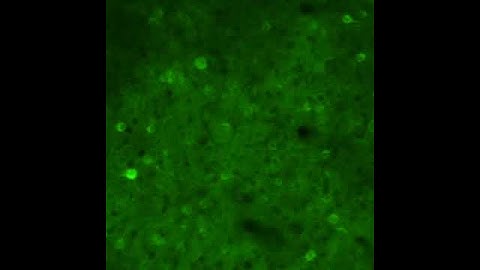 Neuronal Activation from the Retrosplenial Cortex in a Mouse