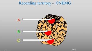 Macro EMG