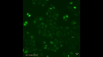 UC Berkeley Calcium Lab Time-Lapse Microscopy