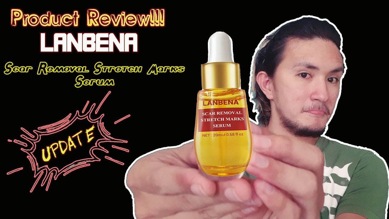 lanbena for stretch marks
