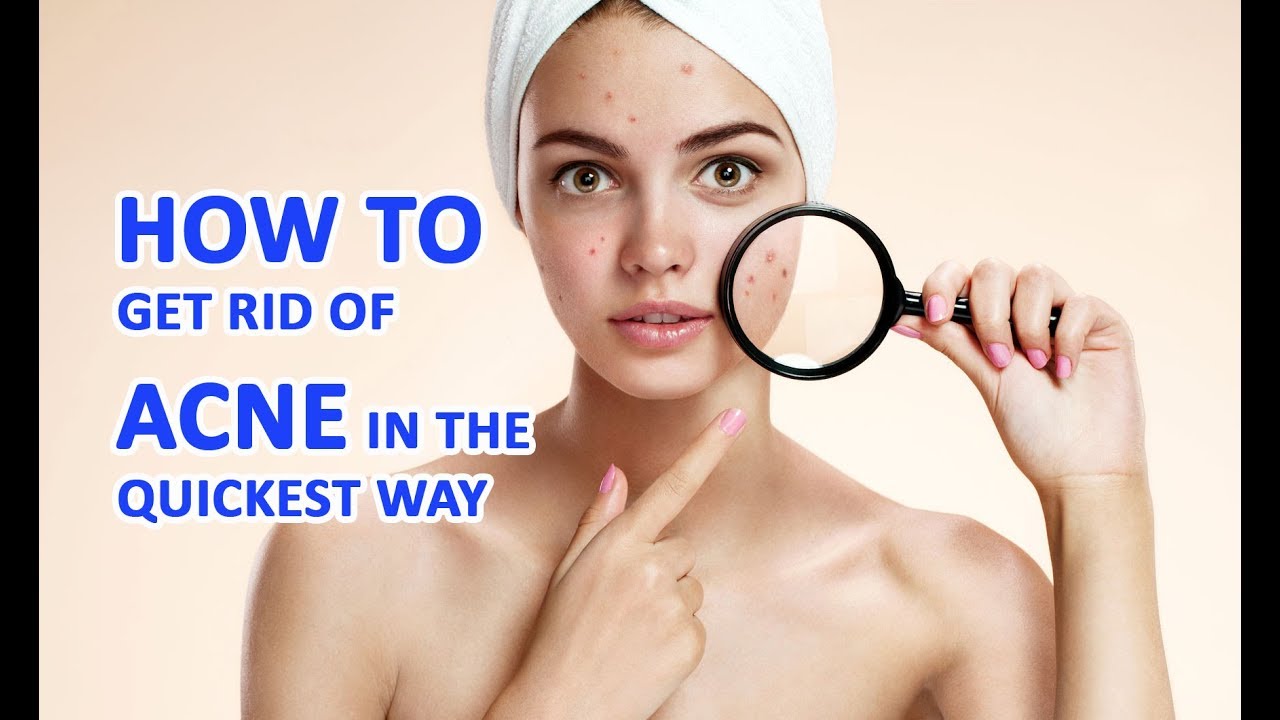 get rid of pimples, get rid of acne, how to remove acne, acne...