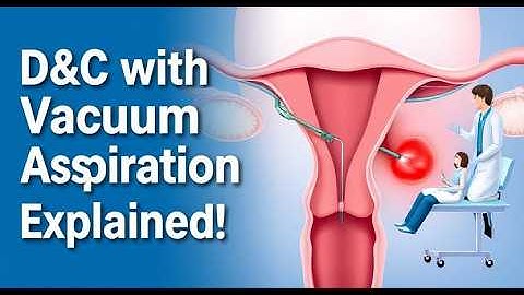 Understanding Dilation and Curettage (D&C) Procedure( 3D Animated ) | D&C vacuum aspirator