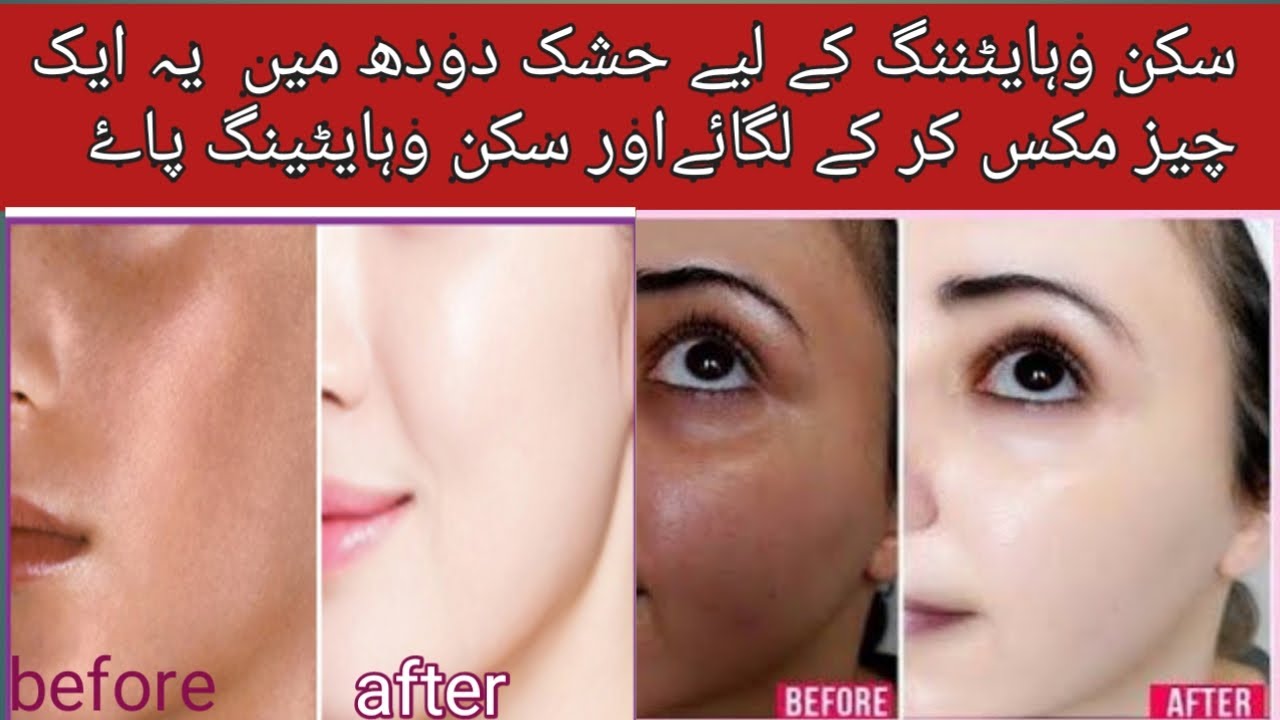 skin whitening home remedies live results!!skin ko white karne ka tarika YouTube