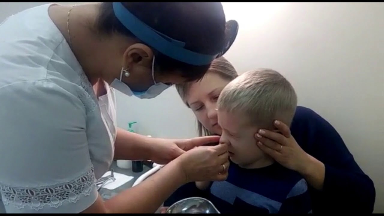 Процедура ямик у детей - YouTube