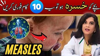 Measles Is Coming - What Parents Need To Knowdr.riffat Omer