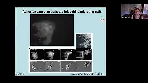 Function of exosome secretion in cancer cell migra...
