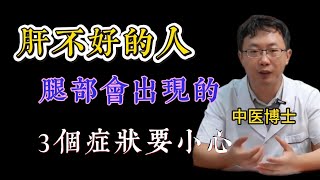 肝脏不好，双腿先知！医生警告：腿上出现这4种异常，你的肝在“求救”！