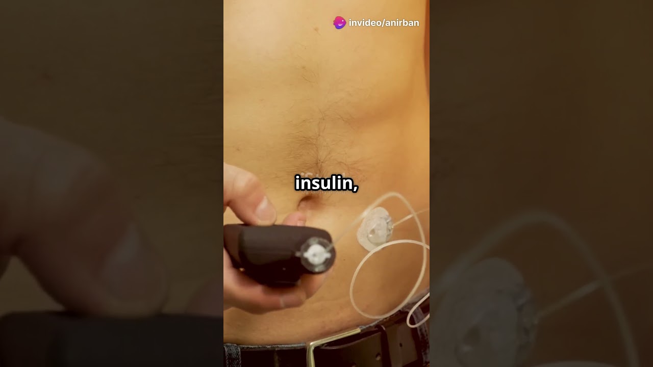 Artificial Pancreas: The Future of Diabetes Control! 🔥