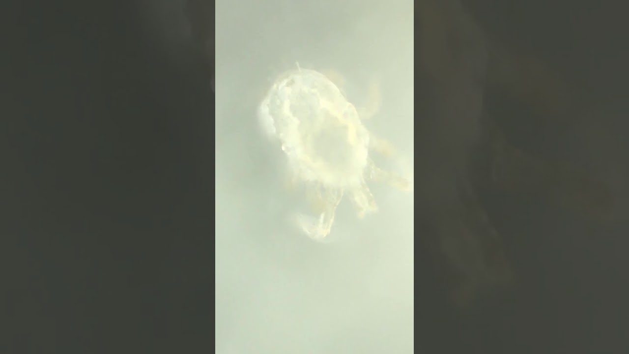 Acarid under TINYSCOPE mobilephone microscope lens