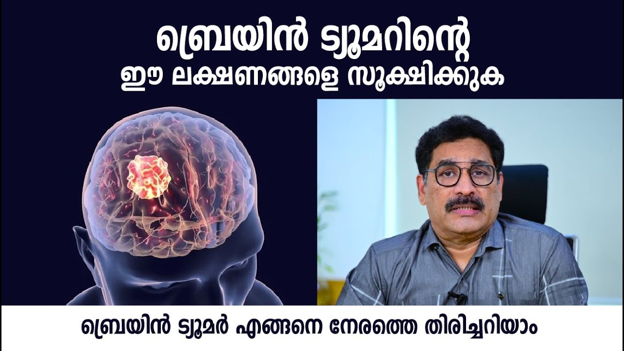 ബ്രെയിൻ ട്യൂമറിന്റെ ഈ ലക്ഷണങ്ങളെ അവഗണിക്കരുത് | Brain Tumor Symptoms | Dr. Shaji K R