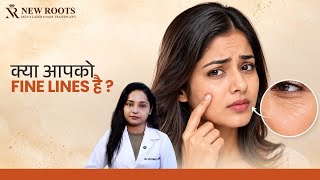 Skin Fine Lines और Wrinkles का सही इलाज 😳 || Causes & Treatment of Wrinkles (In HINDI)